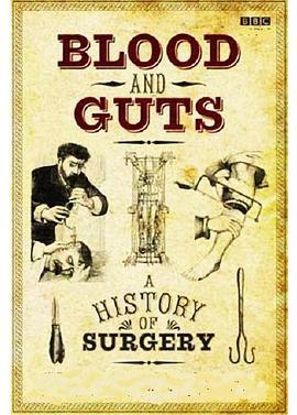 鲜血与内脏:手术的历史第一季